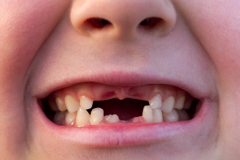 baby teeth eruption chart vibrant